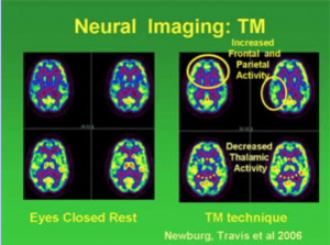 Neural imaging