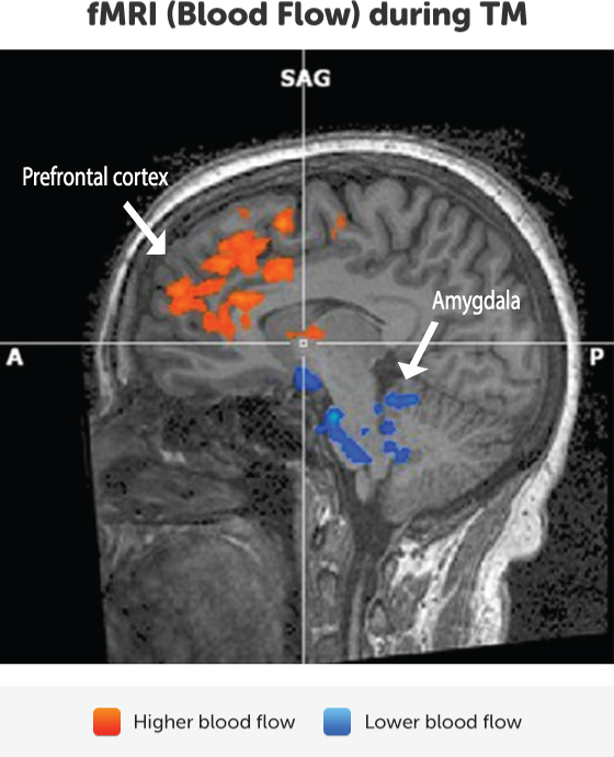 fmri